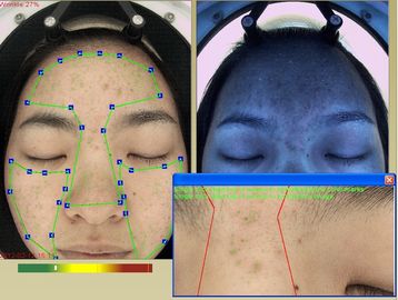분석 기계가 3D를 사용하여 화장품에 의하여 RGB + UV + PL 3 스펙트럼 주름집니다