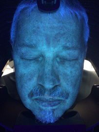 스캐너 진단 기계, 3d Uv 피부 분석을 벗기십시오