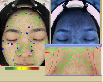 터치스크린을 가진 직업적인 3d 얼굴 피부 수화 해석기 기계