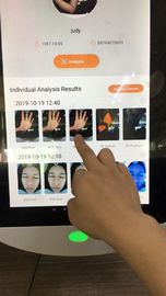 마술 거울 의사 피부 진료소를 위한 휴대용 피부 해석기 Sd 카드 득점방해