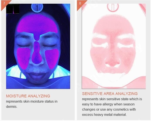Skincare 주름 착색 여드름 피부 분석기 기계 3D 똑똑한 퀴즈