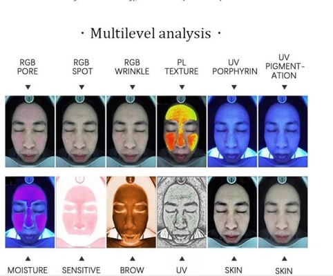 RGB UV PL 안드로이드 전문적 피부 분석기 15MP 얼굴 카메라