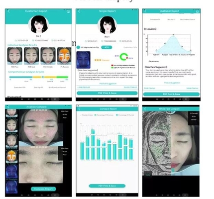 전문적 피부 보습 분석기 얼굴 카메라 10.4 인치 스크린 20MP
