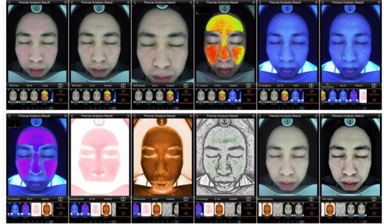 RGB UV PL 스마트 스킨 분석기